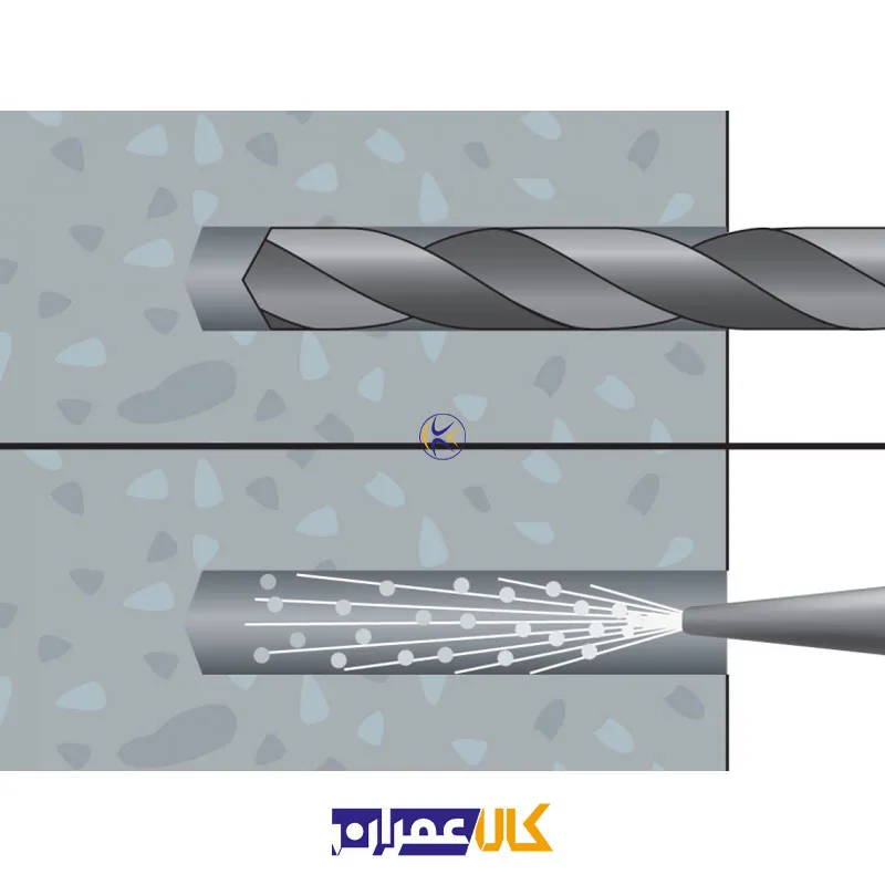 انکر فلزی آپولو